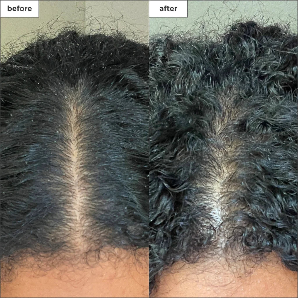 Briogeo Scalp Revival Micro-Exfoliating Shampoo - Image 3