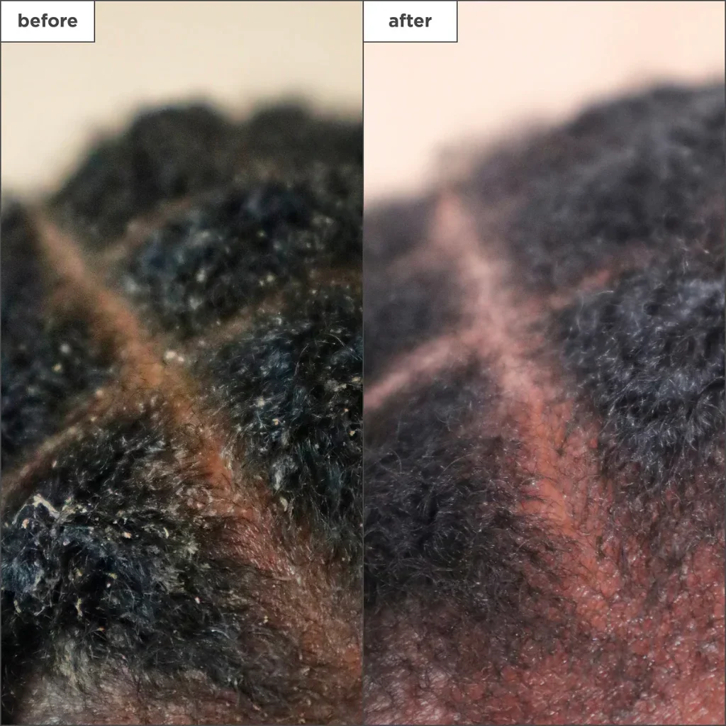 Briogeo Scalp Treatment Drops - Image 2
