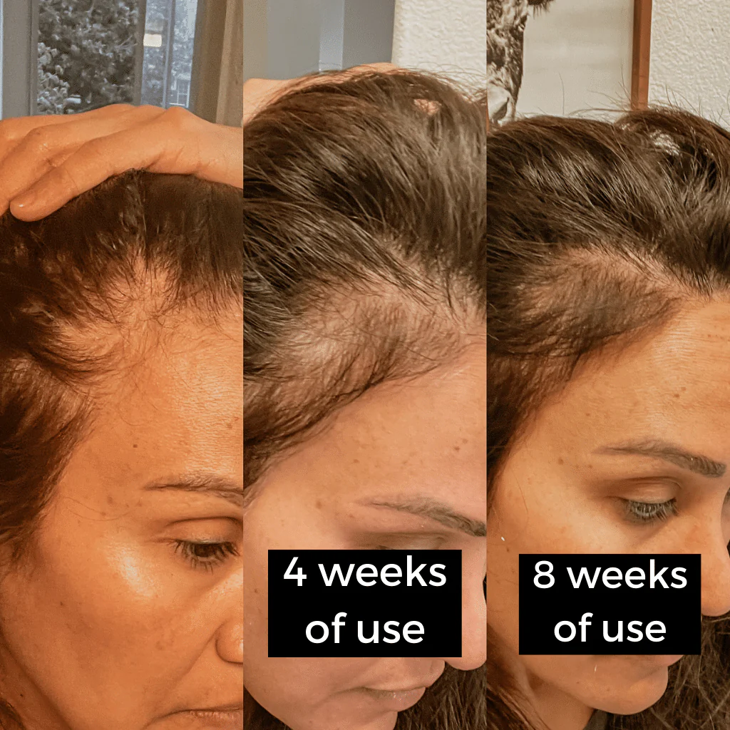juliArt CISPER Hair Revitalizing Shampoo (Oily Scalp) - Image 3