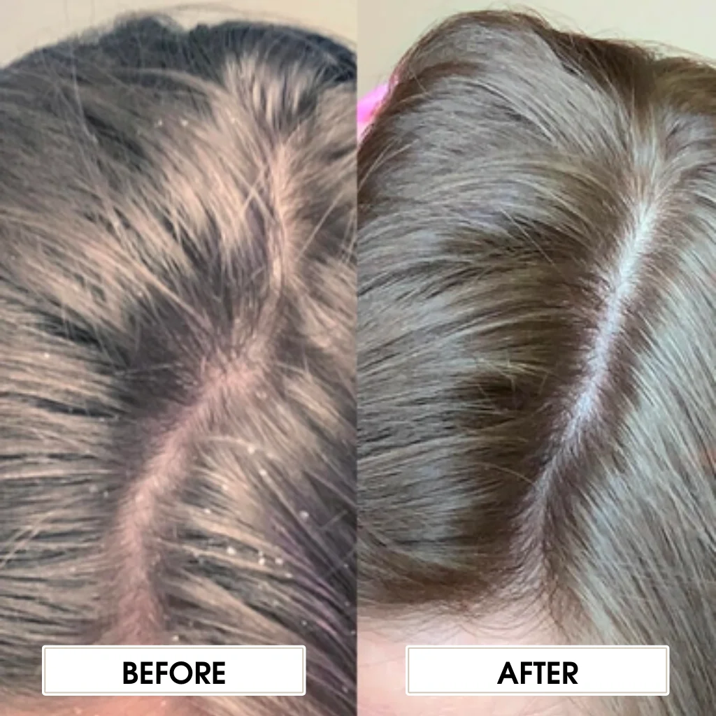 L'ANZA Scalp Balancing Shampoo - Image 2