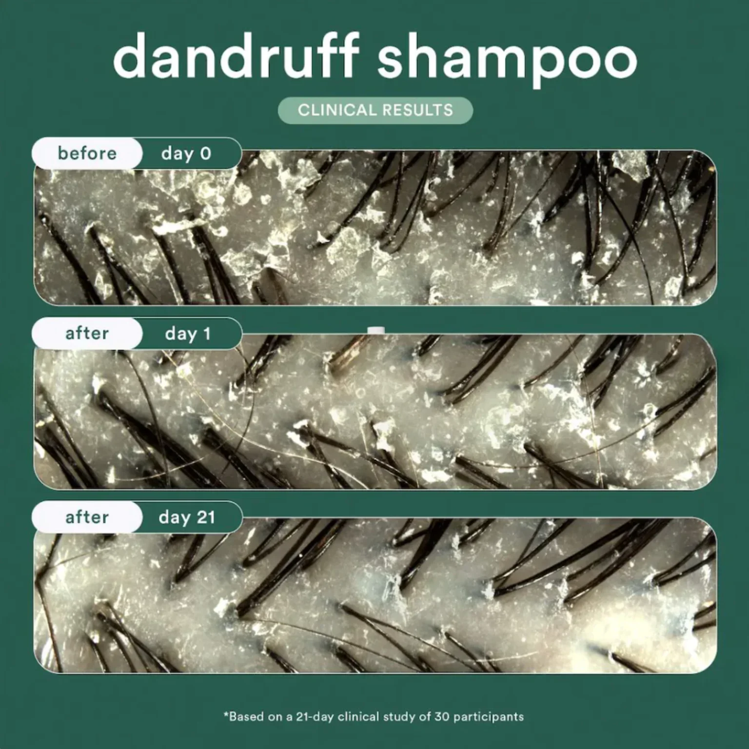 Verb Dandruff Shampoo - Image 5